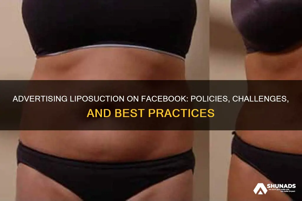 can you advertise liposuction on facebook