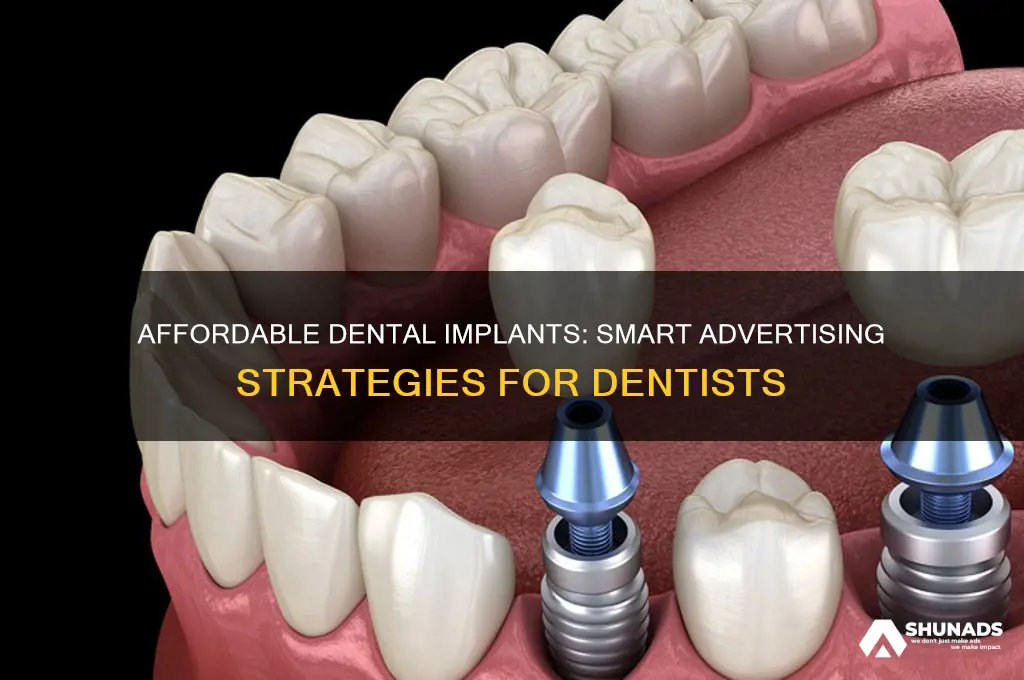 how can dentists keep advertising affordable implants