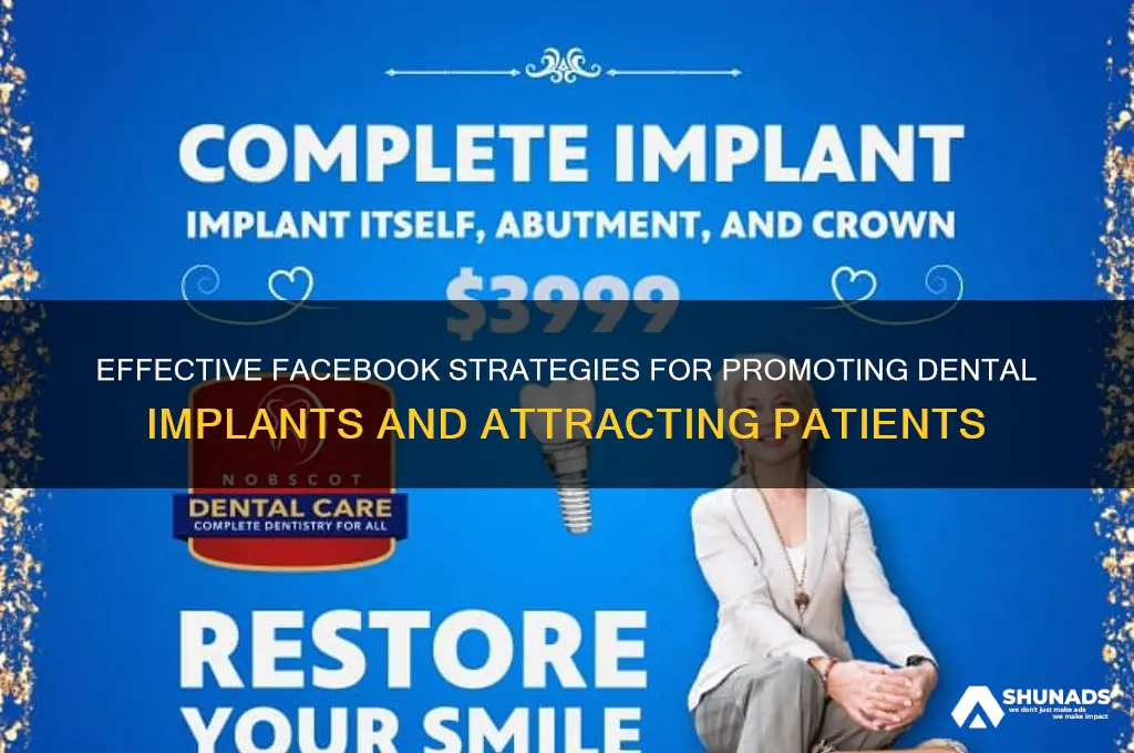 how to advertise dental implants on facebook